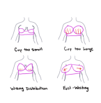 Adventures in Bra Sewing: Figuring Out Fit Part 2: Diagnosing Common ...